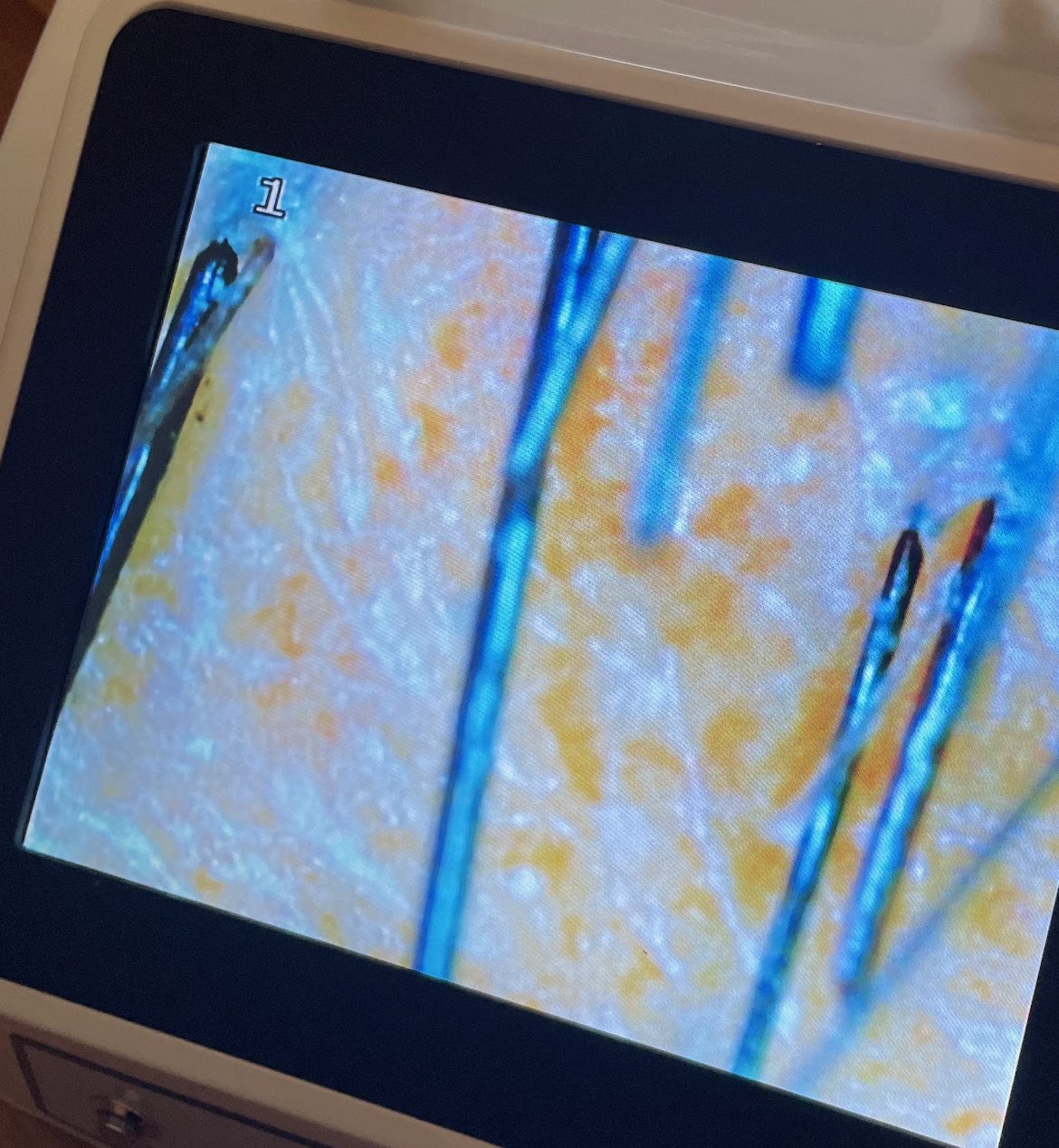 Magnified view of scalp and hair follicles during analysis